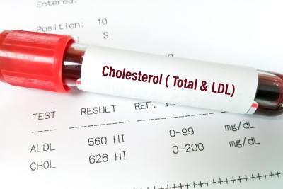 Batas Aman: Panduan Lengkap Jumlah Kadar Kolesterol Normal