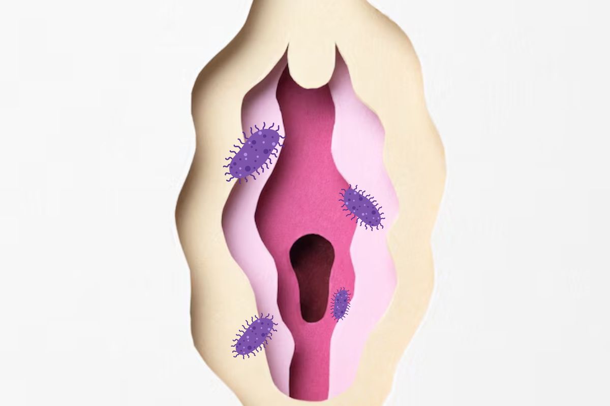 Vagina terserang parasit Trichomonas Vaginalis