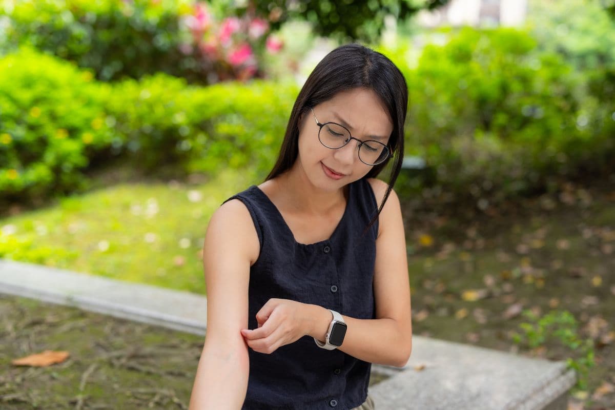 Seorang wanita sedang menggaruk legan yang bentol dan gatal.